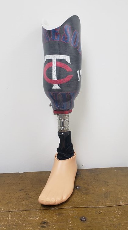 custom prosthetic leg